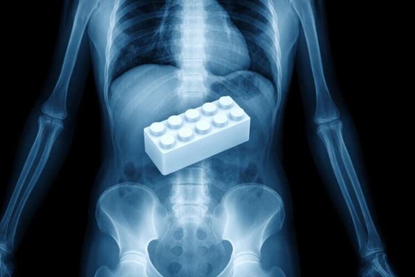 Что будет, если ребенок проглотит Lego: правда от врачей
